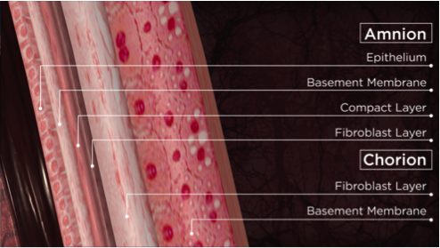 amniotic membrane